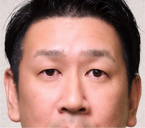 人物写真のレタッチ